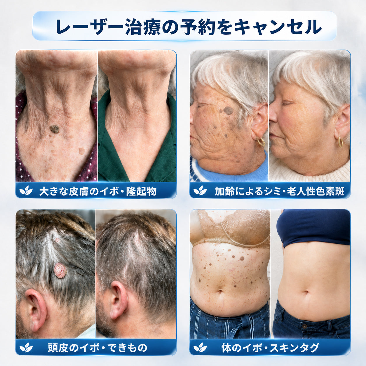 ✨追加ケアがお得！30%OFF💕 Hiskin® タグ＆スポットイレーサー🪄