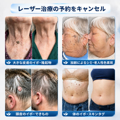 ✨追加ケアがお得！30%OFF💕 Hiskin® タグ＆スポットイレーサー🪄
